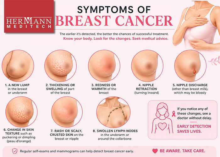 Symptoms of Breast Cancer