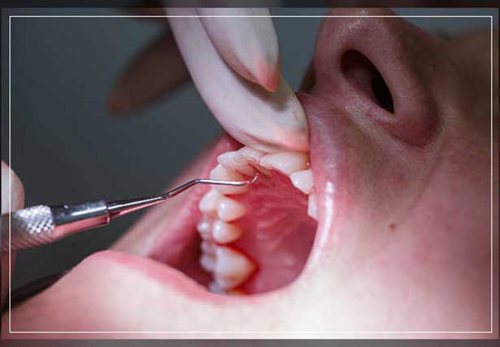 Types Of Dental Instruments - Hermann Meditech